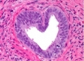 histology_category