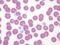 hematologystainseries